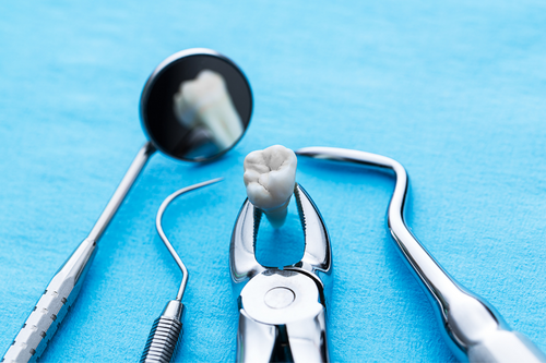 tooth extraction